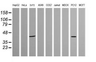 PARVA Antibody (clone OTI2B11)