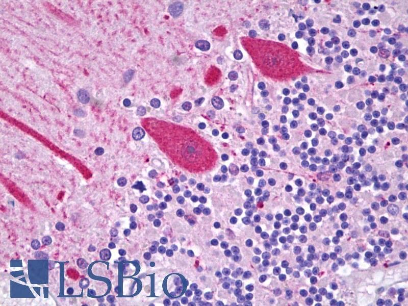 IHC-plus™ Polyclonal Rabbit anti-Human CES2 / Esterase Antibody (C-Terminus, IHC, WB)