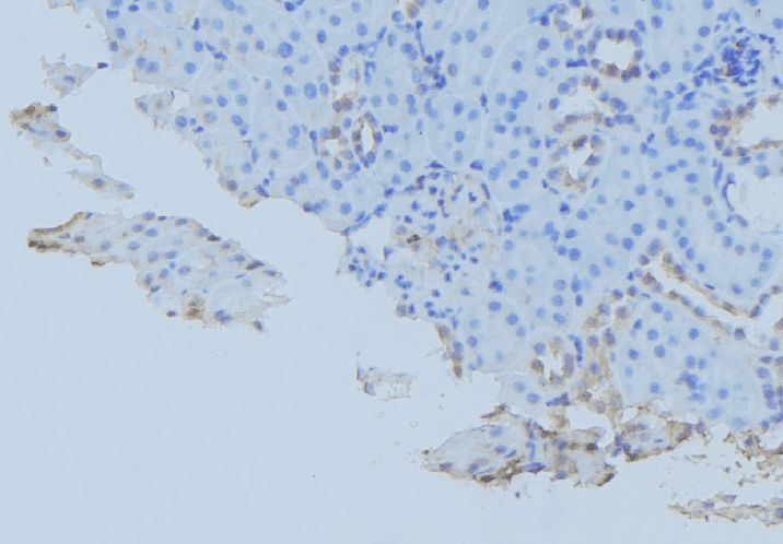 GORASP1 / GRASP65 Antibody
