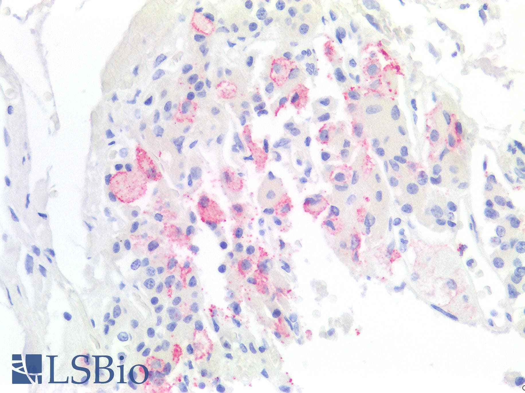 PathPlus™ TBXT / T / Brachyury Antibody (clone RBT-TBXT)