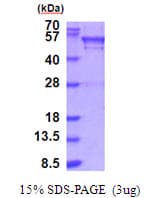 Human UGP2 Protein (Recombinant His)
