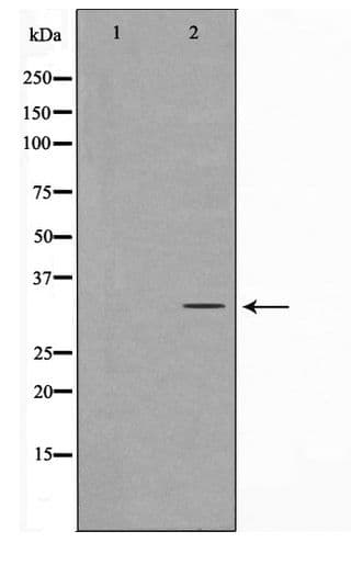 MAST4 Antibody
