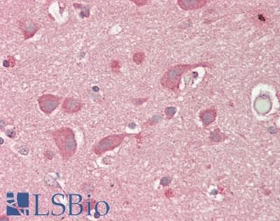 IHC-plus™ LNX1 / LNX Antibody (clone 1H9)