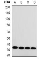 Polyclonal Rabbit anti-Human MGLL / Monoacylglycerol Lipase Antibody (WB)