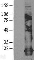 Human CLDN5 / Claudin 5 Protein (Over-Expression Lysate Myc-DDK (Flag))