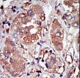 EIF2AK2 / PKR Antibody (aa519-550)