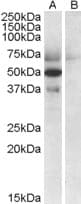 IHC-plus™ APOL4 / Apolipoprotein L 4 Antibody (aa336-349)