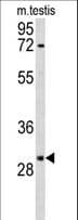 RPA2 / RFA2 / RPA34 Antibody (aa66-96)