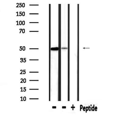 SLC38A2 / SNAT2 Antibody (aa173-192)