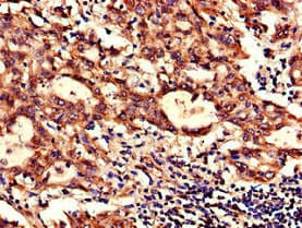 Polyclonal Rabbit anti-Human NDUFB6 Antibody