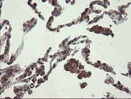 UBE2J1 Antibody (clone OTI3D1)