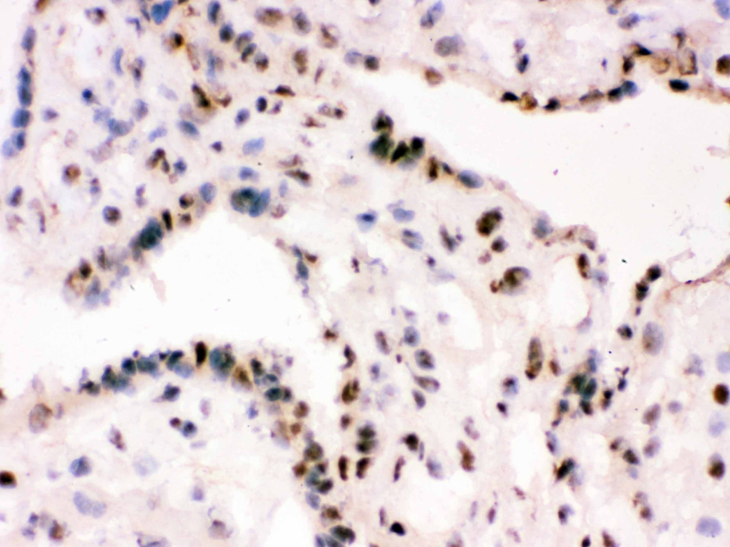 RBBP4 / RBAP48 Antibody (aa395-425)