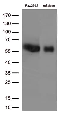 Monoclonal Mouse anti-Human FCGR1A / CD64 Antibody (clone UMAB74, IHC, WB)