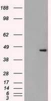IHC-plus™ Monoclonal Mouse anti-Human SSB / La Antibody (clone 9D6, IHC, IF, WB)
