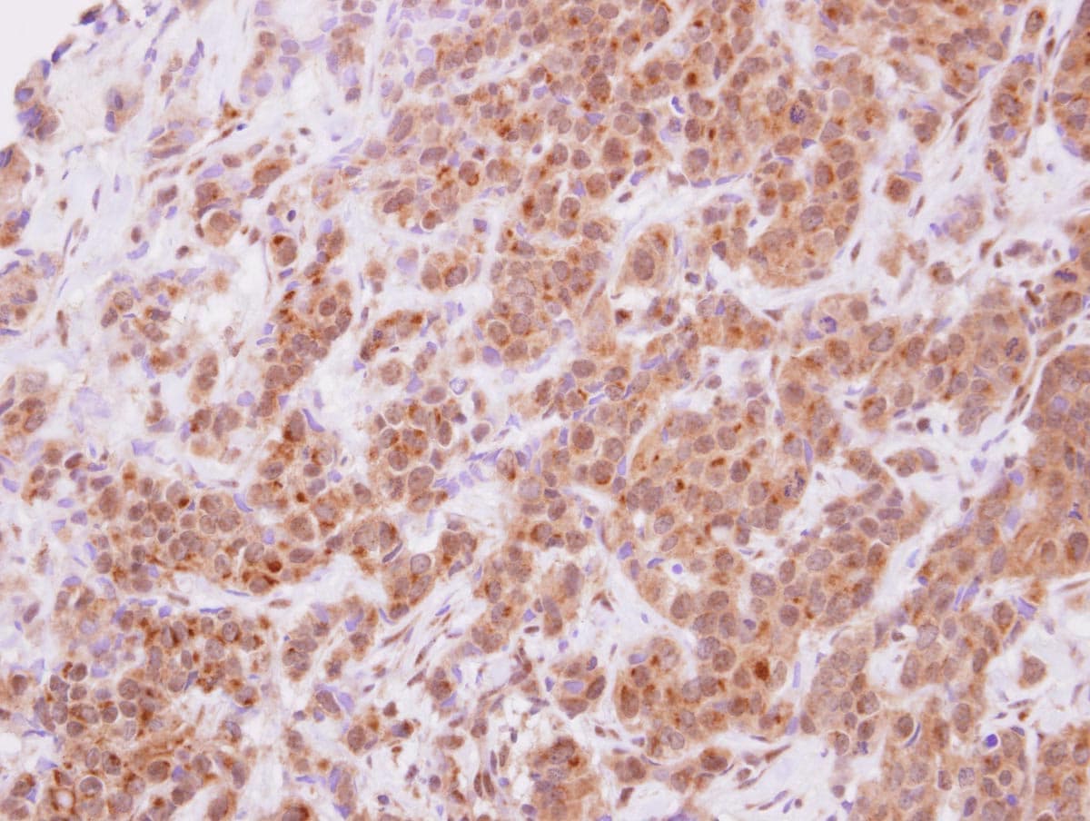 Polyclonal Rabbit anti-Human STYXL1 Antibody (IHC, WB)