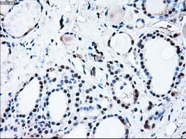 BRAF / B-Raf Antibody (clone OTI1G8)
