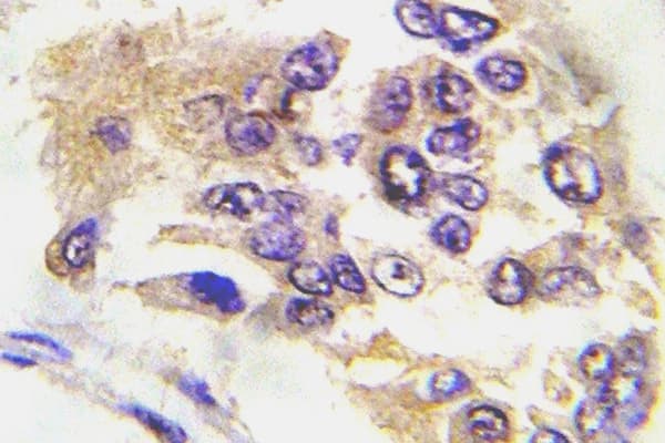 Polyclonal Rabbit anti-Human PRKAA1 / AMPK Alpha 1 Antibody (phospho-Thr174, IHC, WB)