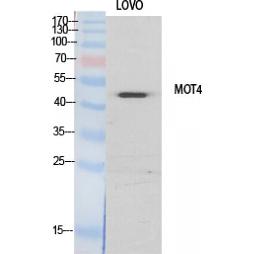 Polyclonal Rabbit anti-Human SLC16A3 Antibody (210-290 aa, Internal, WB)