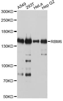 RBM6 / 3G2 Antibody