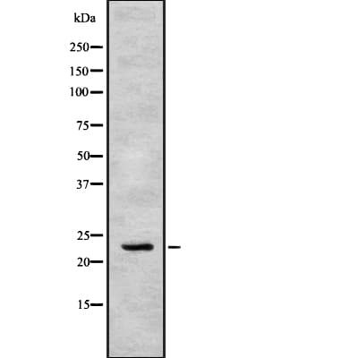 APOBEC3C Antibody