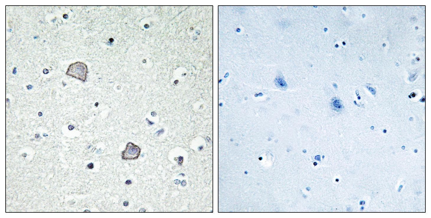 Polyclonal Rabbit anti-Human LPAR1 / LPA1 / EDG2 Antibody (IHC, IF, WB)