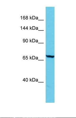 ADGB Antibody (aa1490-1539)