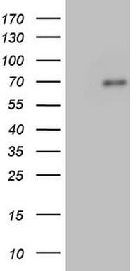 Monoclonal Mouse anti-Human FN1 / Fibronectin Antibody (clone OTI1G2, aa32-307, IHC, WB)