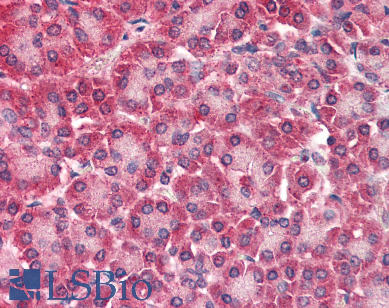 IHC-plus™ Polyclonal Goat anti-Human CARD6 Antibody (aa2-15, IHC)