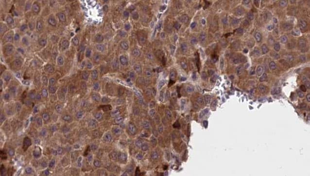 AP50 / AP2M1 Antibody