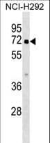 ZNF851 / ZBTB44 Antibody (aa425-453)