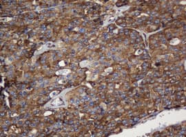 PAI-RBP1 / SERBP1 Antibody (clone OTI5G2)