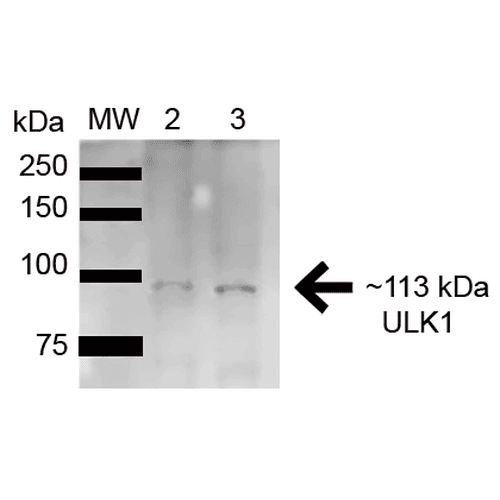 ULK1 Antibody (RPE)