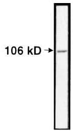 IHC-plus™ Polyclonal Rabbit anti-Human NCL / Nucleolin Antibody (aa284-709, IHC, IF, WB)