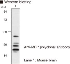 Polyclonal Rabbit anti-Human MBP / Myelin Basic Protein Antibody (WB)
