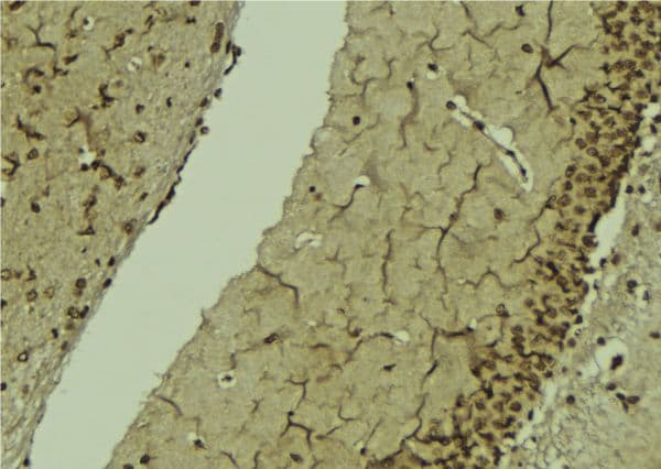 Polyclonal Rabbit anti-Human POLB / DNA Polymerase Beta Antibody (IHC, IF, WB)