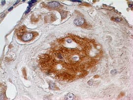 Osteonectin / SPARC Antibody (aa46-63)