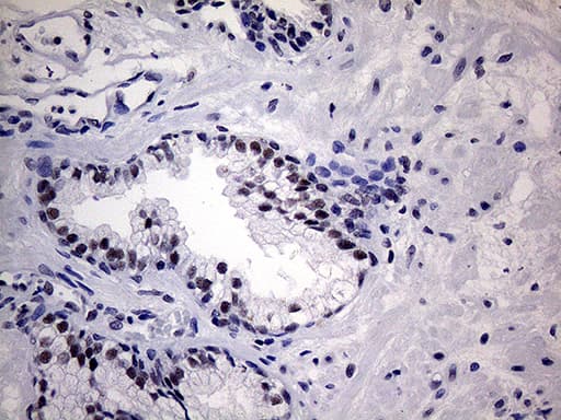 Monoclonal Mouse anti-Human WTAP Antibody (clone OTI6C3, aa2-106, IHC, WB)