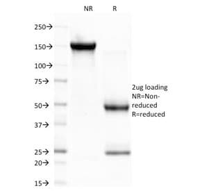 CELA3B / ELA3B Antibody (clone CELA3B/1757)