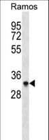 AURKB / Aurora-B Antibody (aa84-111)