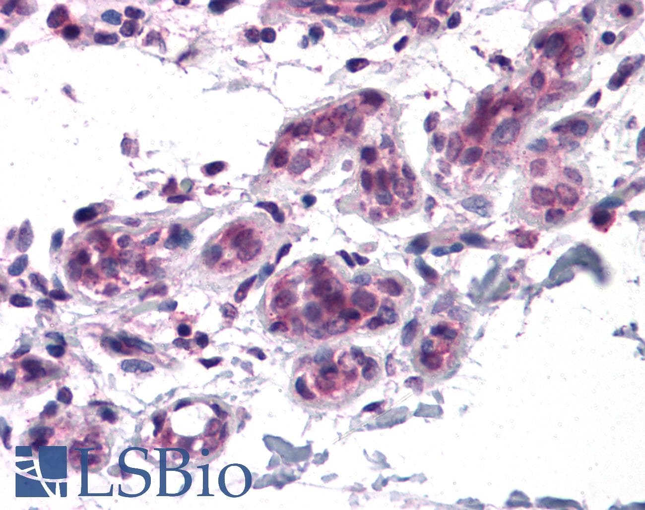 IHC-plus™ Polyclonal Rabbit anti-Human BCAS3 Antibody (IHC, IF, WB)