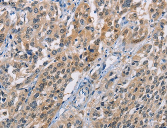 CBR / CBR1 Antibody