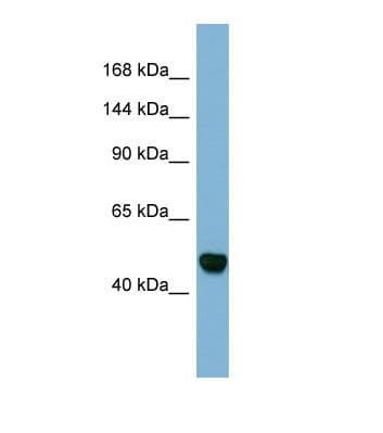 Polyclonal Rabbit anti-Human MAML3 / CAGH3 Antibody (aa952-1001, WB)