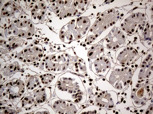Monoclonal Mouse anti-Human HNRNPH1 / hnRNP H Antibody (clone OTI1H3, Carrier-free, IHC, WB)
