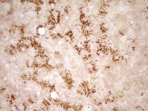 HGF / Hepatocyte Growth Factor Antibody (aa200-494, clone OTI2F3)