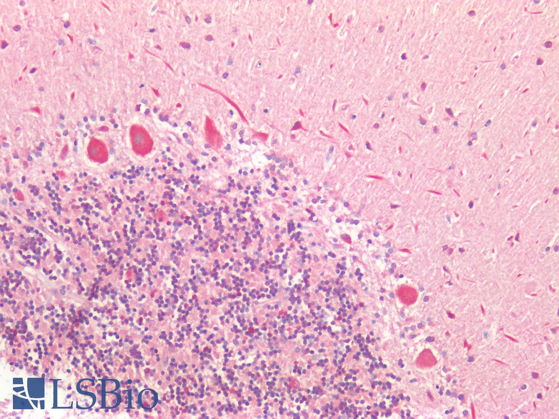 PathPlus™ GRB7 Antibody