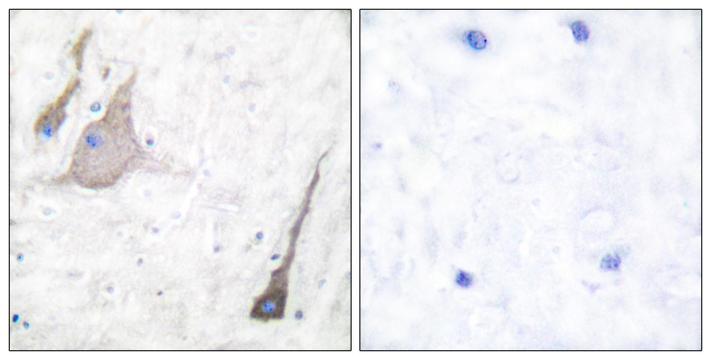 Polyclonal Rabbit anti-Human SNCA / Alpha-Synuclein Antibody (IHC, WB)