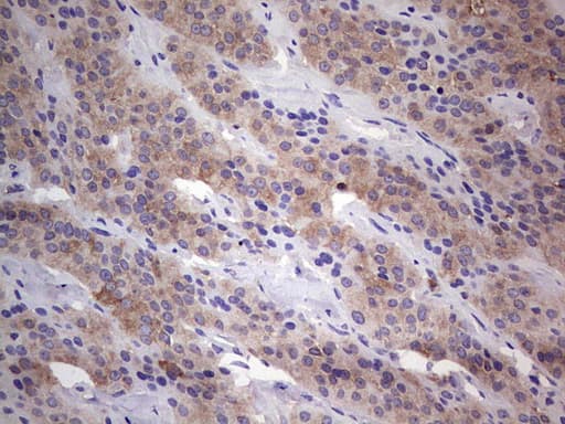 Monoclonal Mouse anti-Human PKM2 Antibody (clone 1F12, IHC, WB)