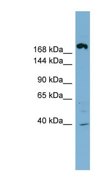 Polyclonal Rabbit anti-Human ABCC11 / MRP8 Antibody (aa1295-1344, WB)
