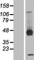 PPM1B Protein (Over-Expression Lysate Myc-DDK (Flag))