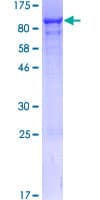 Human NVL Protein (Recombinant GST)